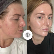 Lade das Bild in den Galerie-Viewer, Clear Skin Set

