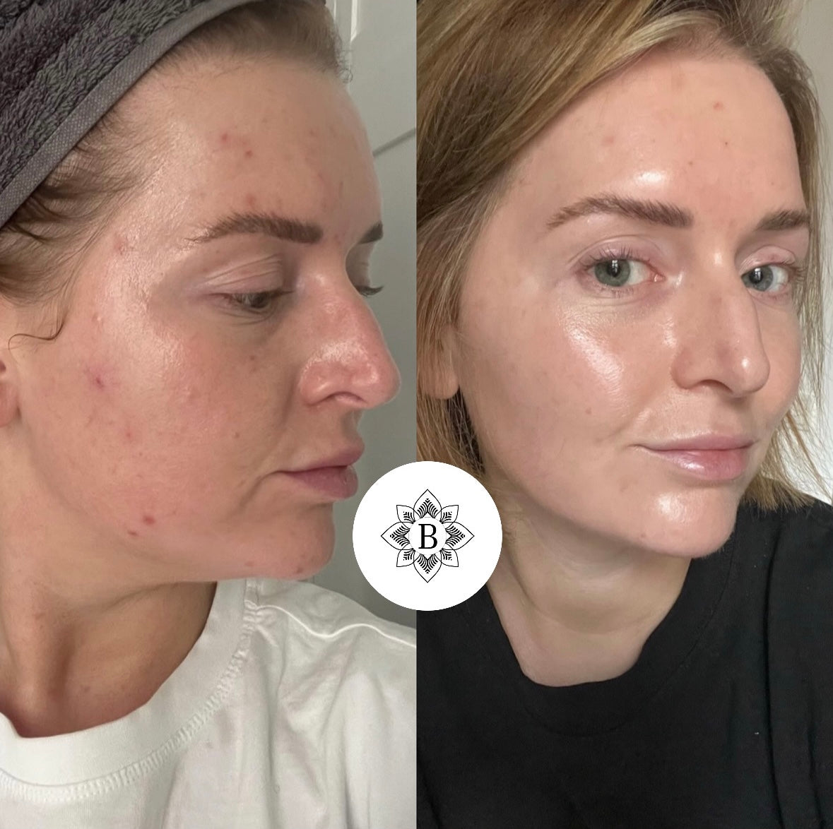Neroli Serum